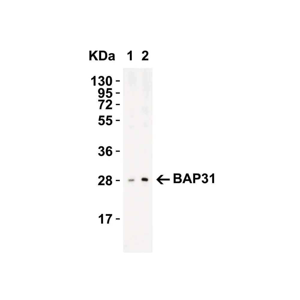 ProSci 3665 BAP31 Antibody, ProSci, 0.1 mg/Unit Tertiary Image
