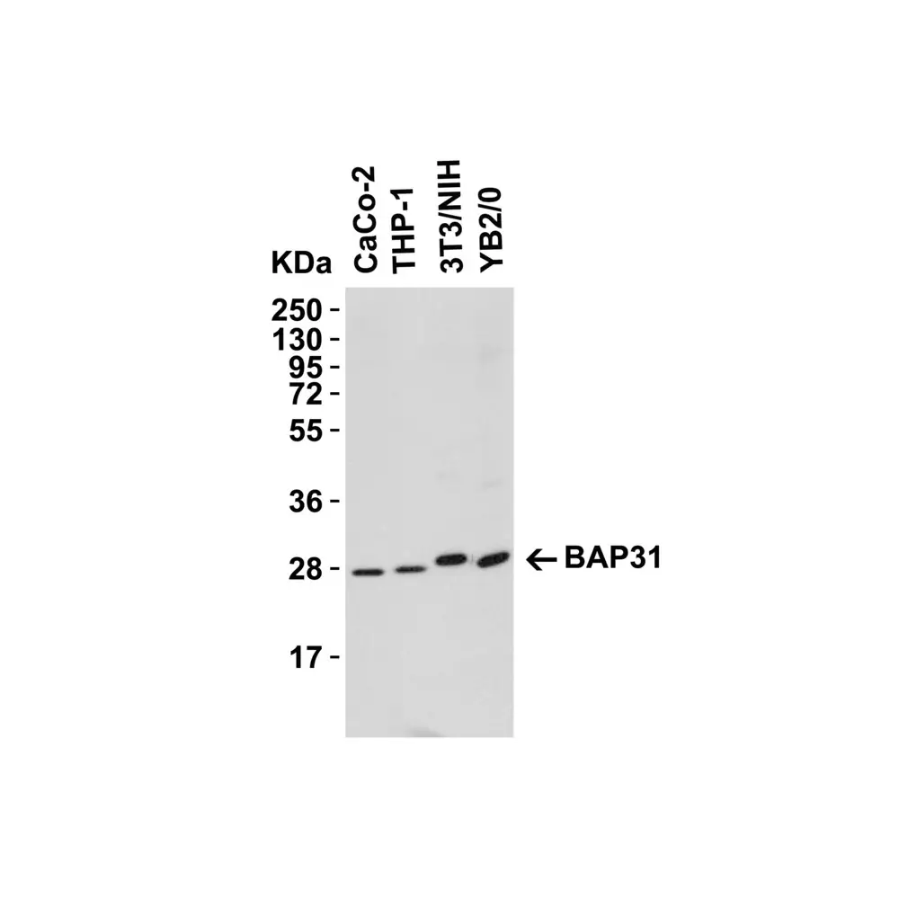 ProSci 3675_S BAP31 Antibody, ProSci, 0.02 mg/Unit Tertiary Image
