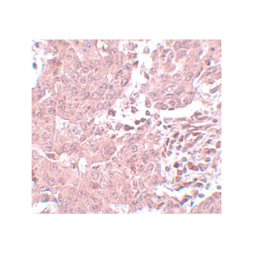 ProSci 5629 BCAS3 Antibody, ProSci, 0.1 mg/Unit Secondary Image
