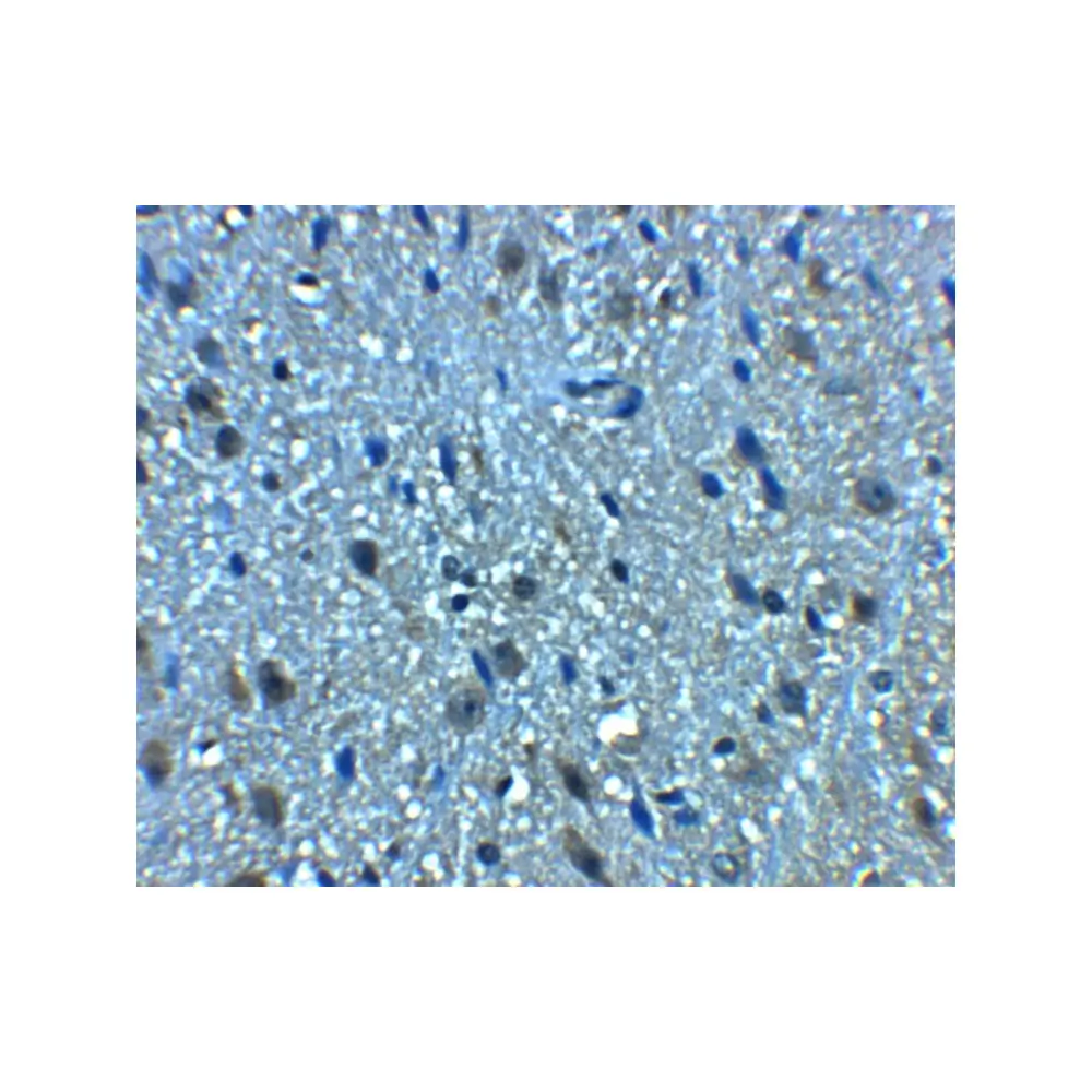 ProSci 8373 BCLAF1 Antibody, ProSci, 0.1 mg/Unit Secondary Image