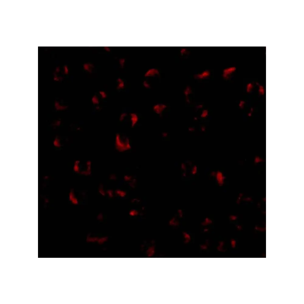 ProSci 3755_S BMI-1 Antibody, ProSci, 0.02 mg/Unit Tertiary Image