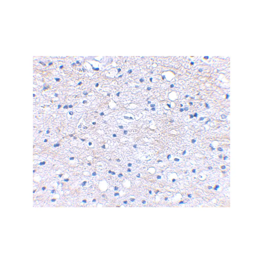 ProSci 4501 BRAL1 Antibody, ProSci, 0.1 mg/Unit Secondary Image