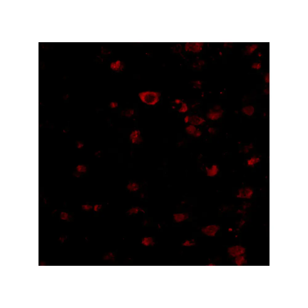 ProSci 4081_S BRSK1 Antibody, ProSci, 0.02 mg/Unit Tertiary Image