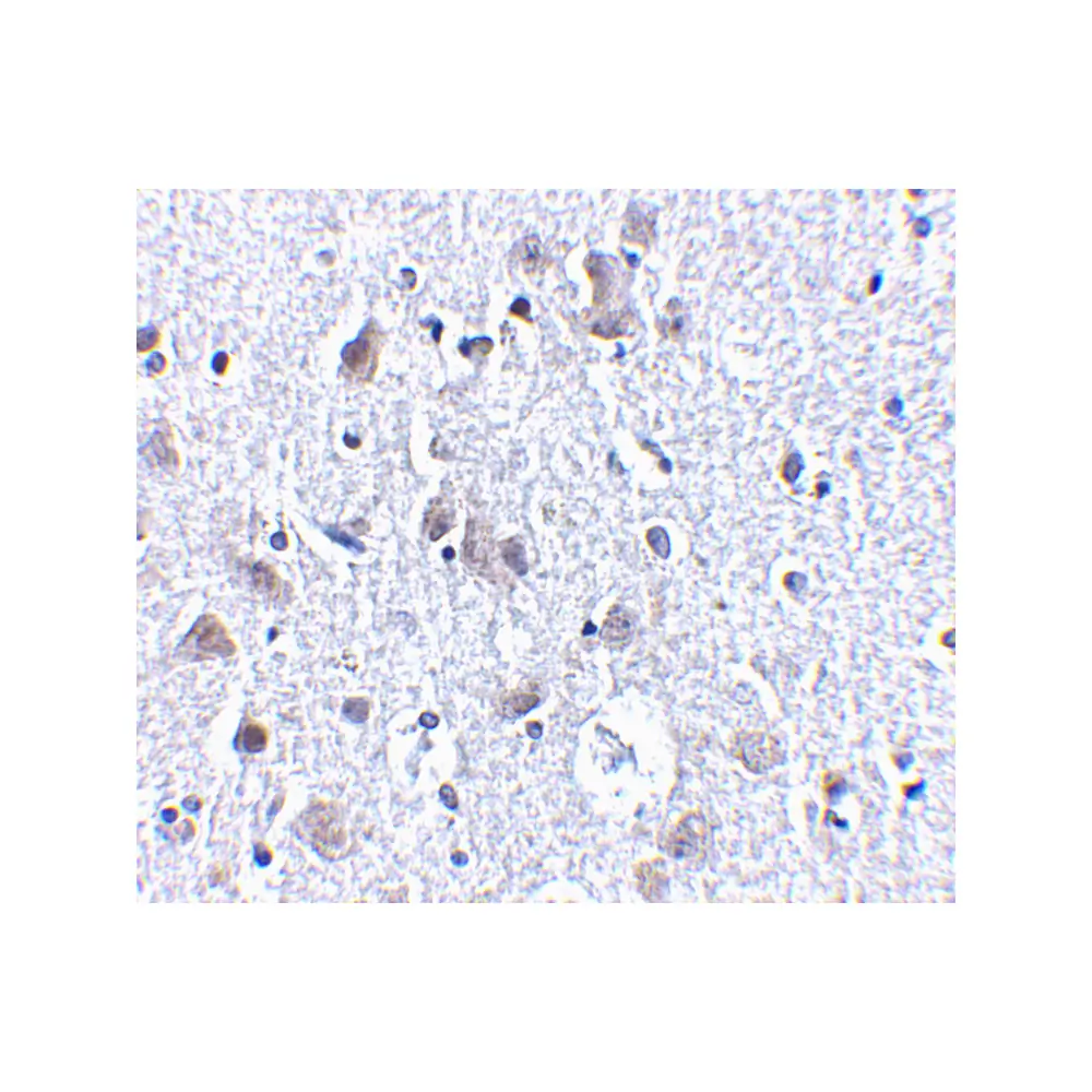 ProSci 4081_S BRSK1 Antibody, ProSci, 0.02 mg/Unit Secondary Image