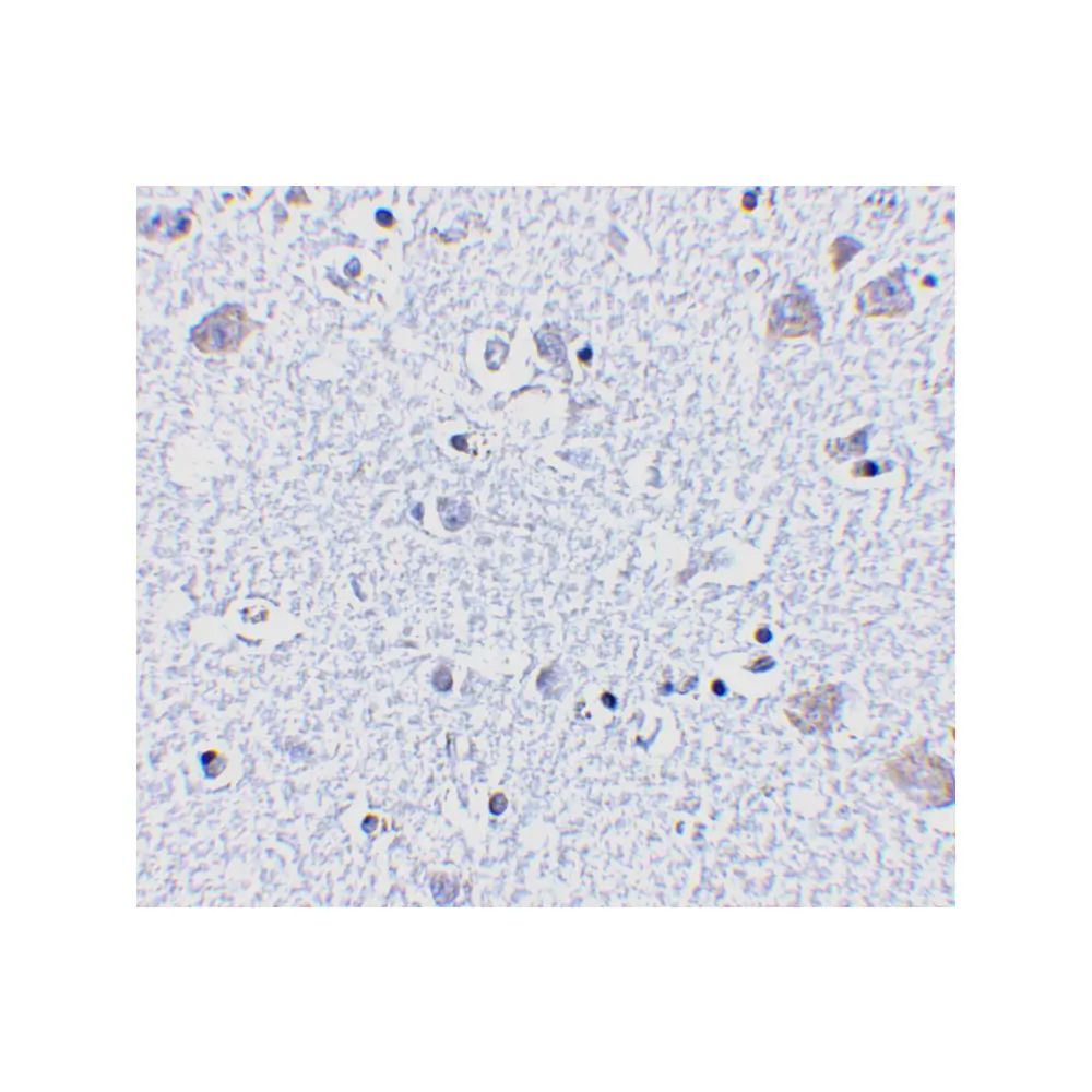 ProSci 4083_S BRSK1 Antibody, ProSci, 0.02 mg/Unit Secondary Image