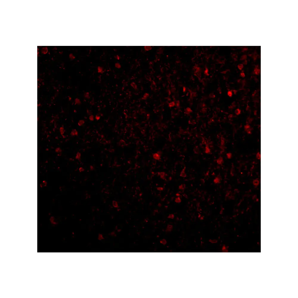 ProSci 4085 BRSK2 Antibody, ProSci, 0.1 mg/Unit Tertiary Image
