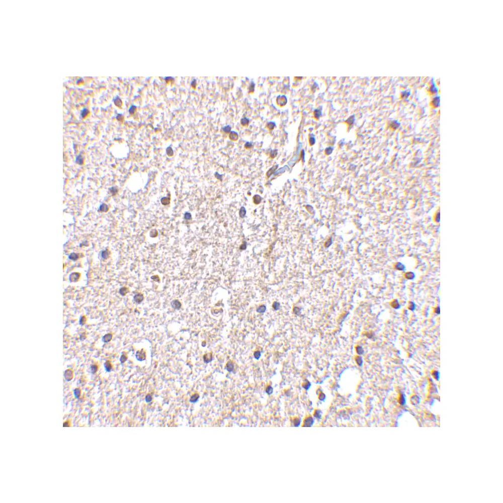 ProSci 4085 BRSK2 Antibody, ProSci, 0.1 mg/Unit Secondary Image