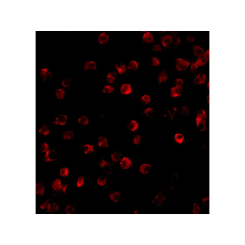 ProSci 3395_S BTK Antibody, ProSci, 0.02 mg/Unit Tertiary Image