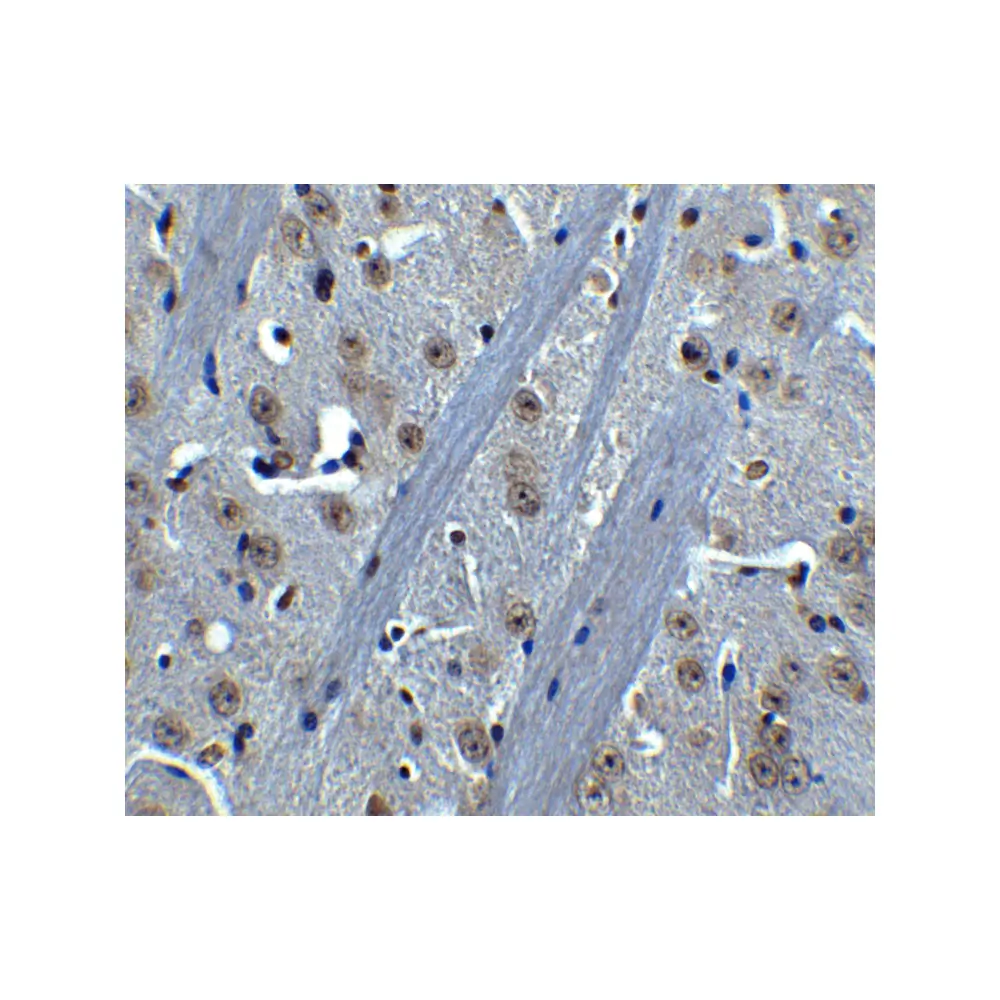 ProSci 3395_S BTK Antibody, ProSci, 0.02 mg/Unit Secondary Image