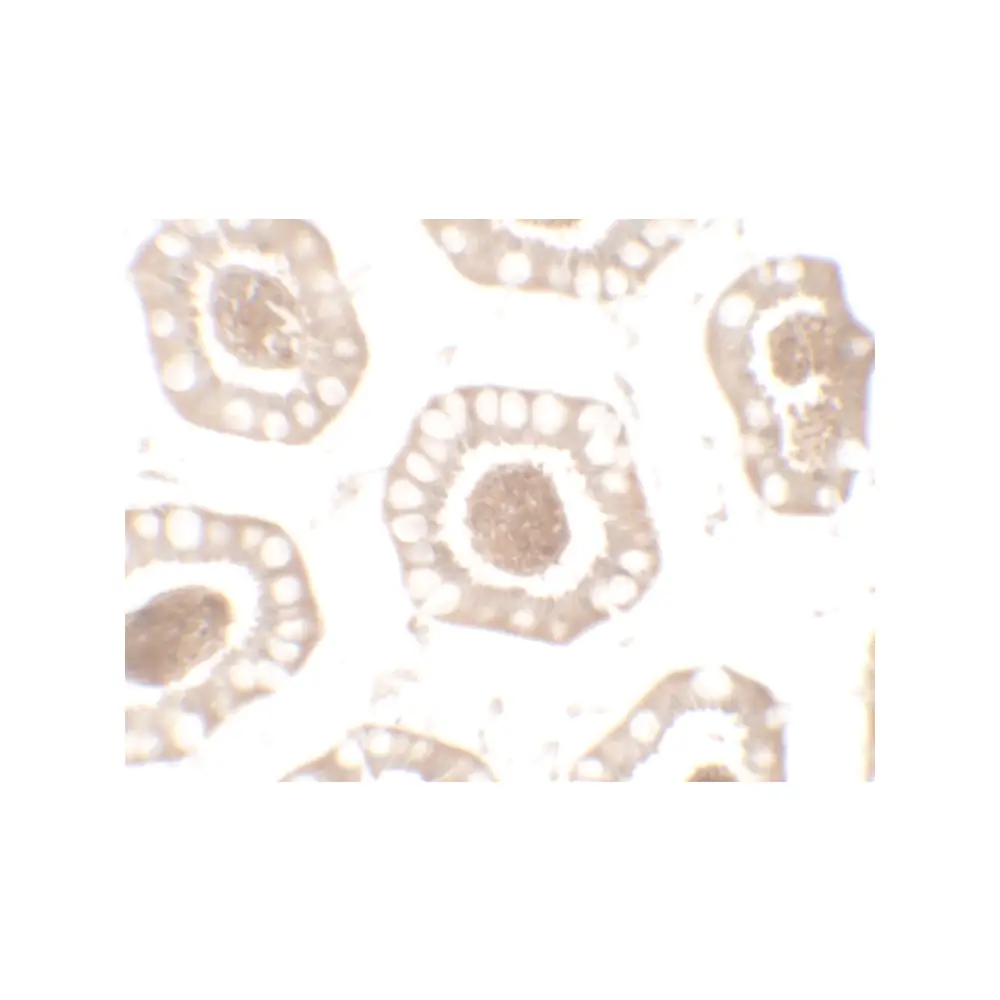 ProSci 7473 BTLA Antibody , ProSci, 0.1 mg/Unit Secondary Image