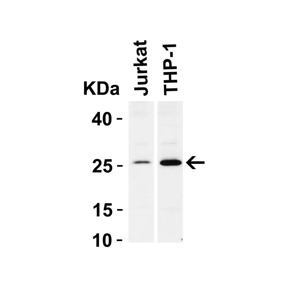 ProSci 3337 Bcl-2 Antibody, ProSci, 0.1 mg/Unit Tertiary Image