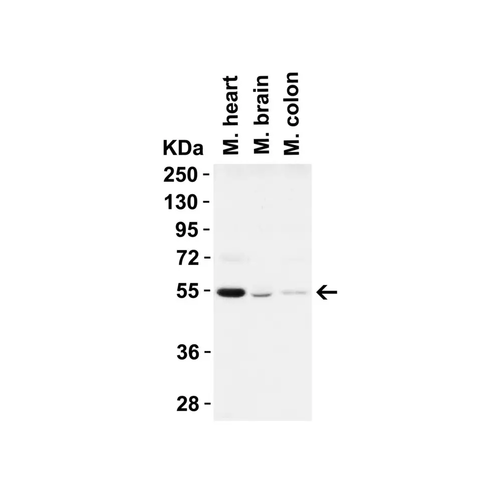 ProSci 3613 Beclin-1 Antibody, ProSci, 0.1 mg/Unit Secondary Image