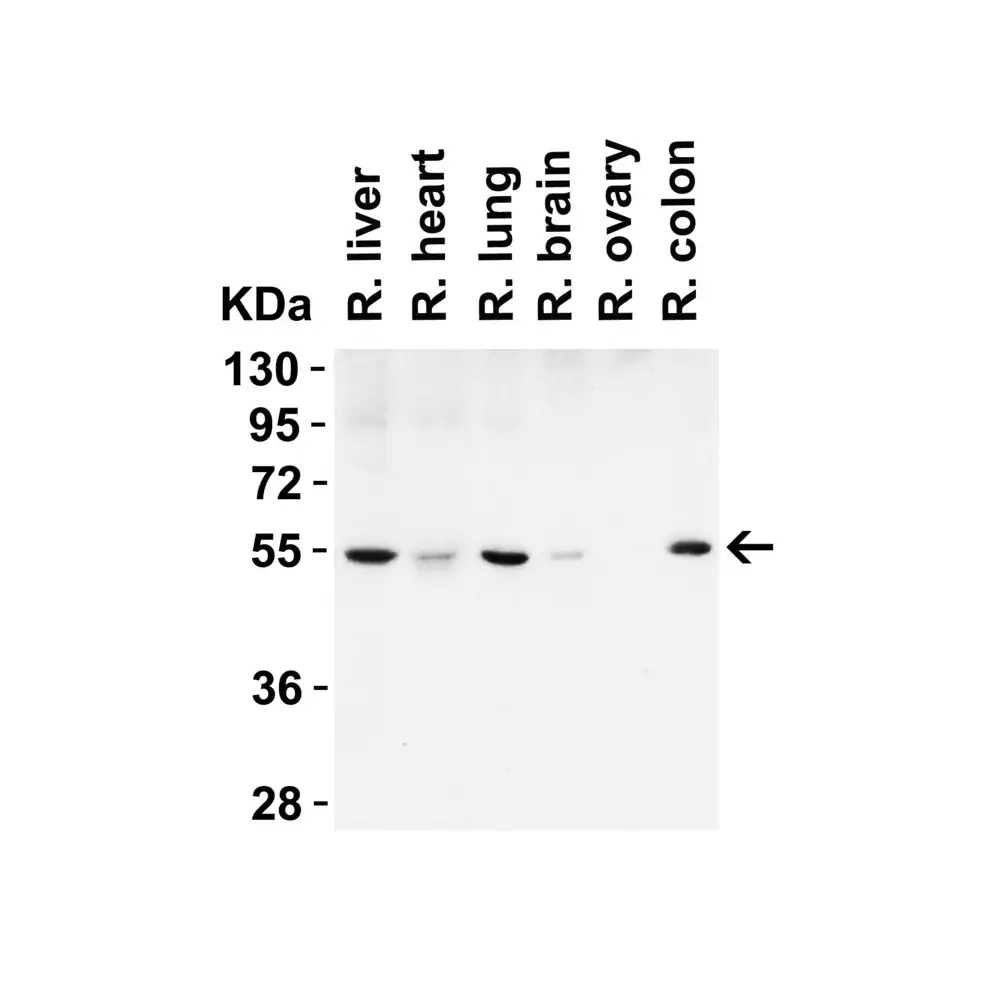 ProSci 3613 Beclin-1 Antibody, ProSci, 0.1 mg/Unit Tertiary Image