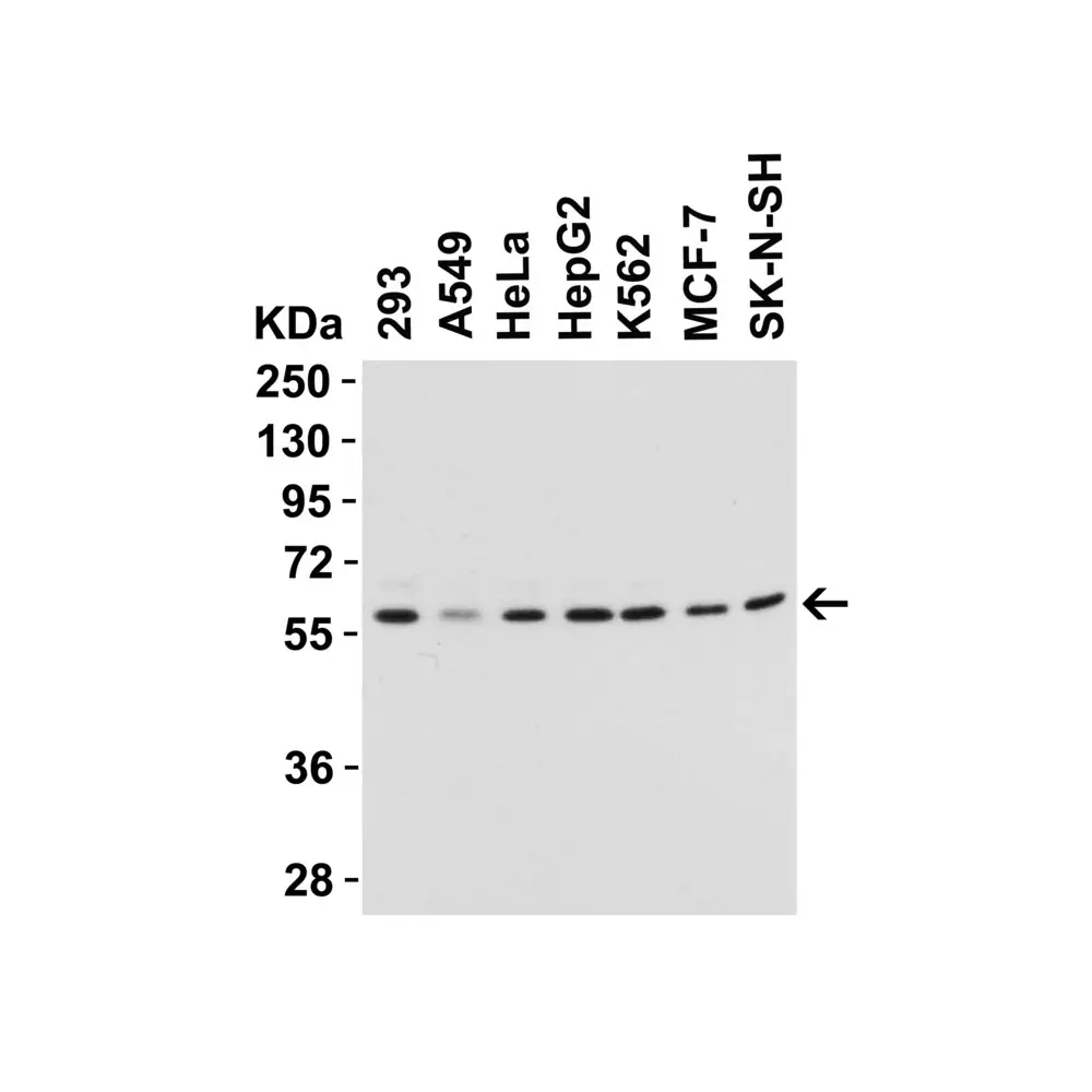 ProSci 3613 Beclin-1 Antibody, ProSci, 0.1 mg/Unit Primary Image