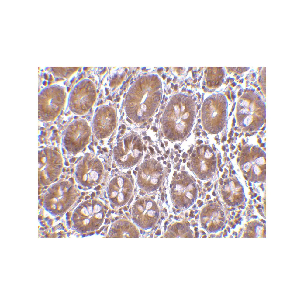 ProSci 3605 Bit1 Antibody, ProSci, 0.1 mg/Unit Secondary Image