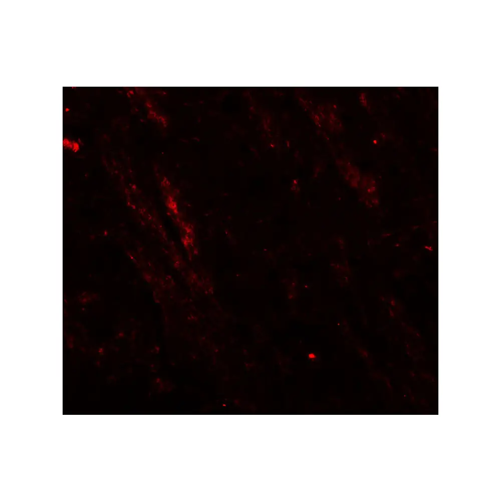 ProSci 8029_S CACNA1H Antibody, ProSci, 0.02 mg/Unit Tertiary Image