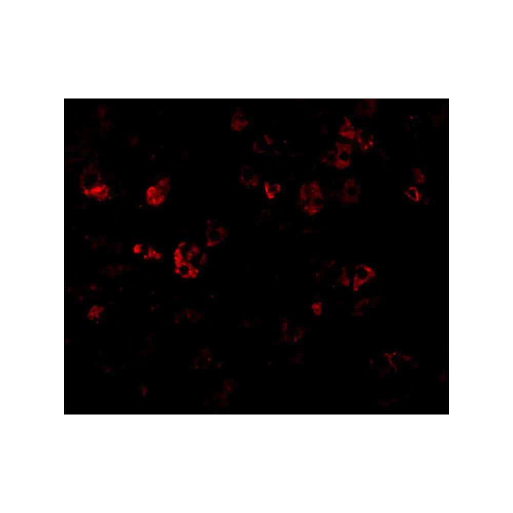 ProSci 2011_S CAD Antibody, ProSci, 0.02 mg/Unit Tertiary Image