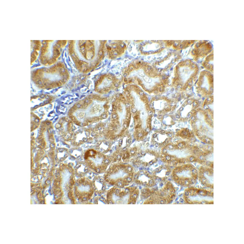 ProSci 2011 CAD Antibody, ProSci, 0.1 mg/Unit Quaternary Image