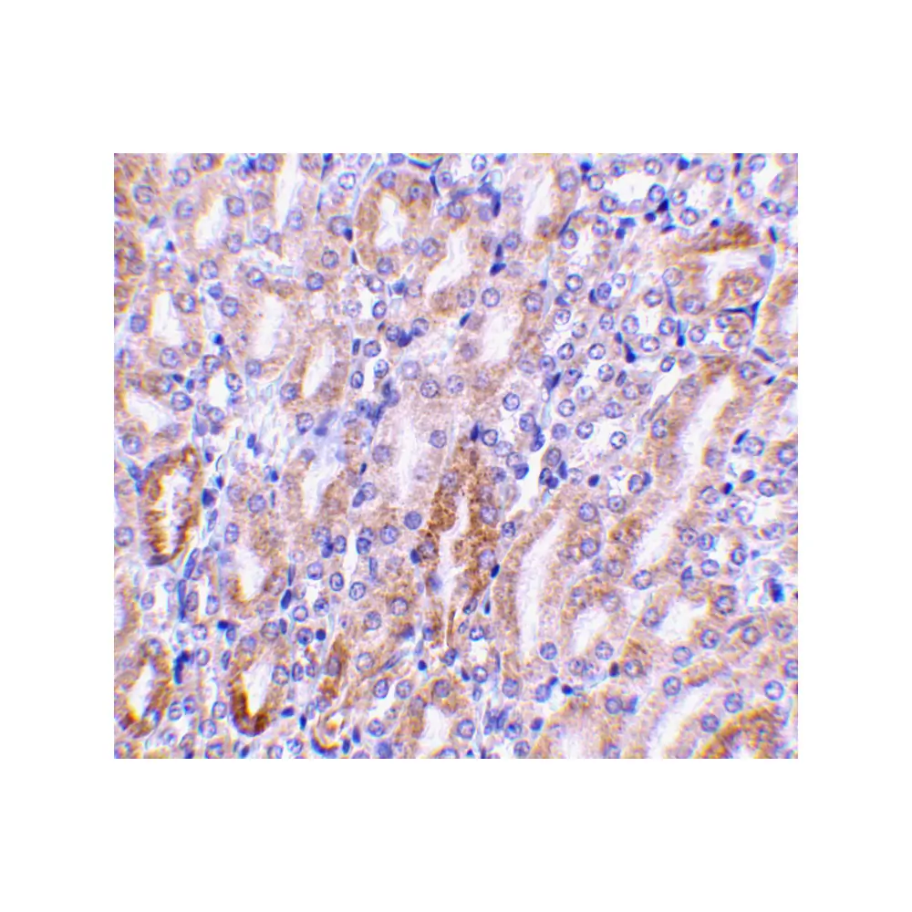 ProSci 2011_S CAD Antibody, ProSci, 0.02 mg/Unit Secondary Image