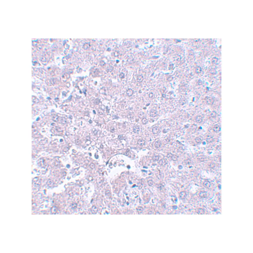 ProSci 5593 CALHM1 Antibody, ProSci, 0.1 mg/Unit Secondary Image