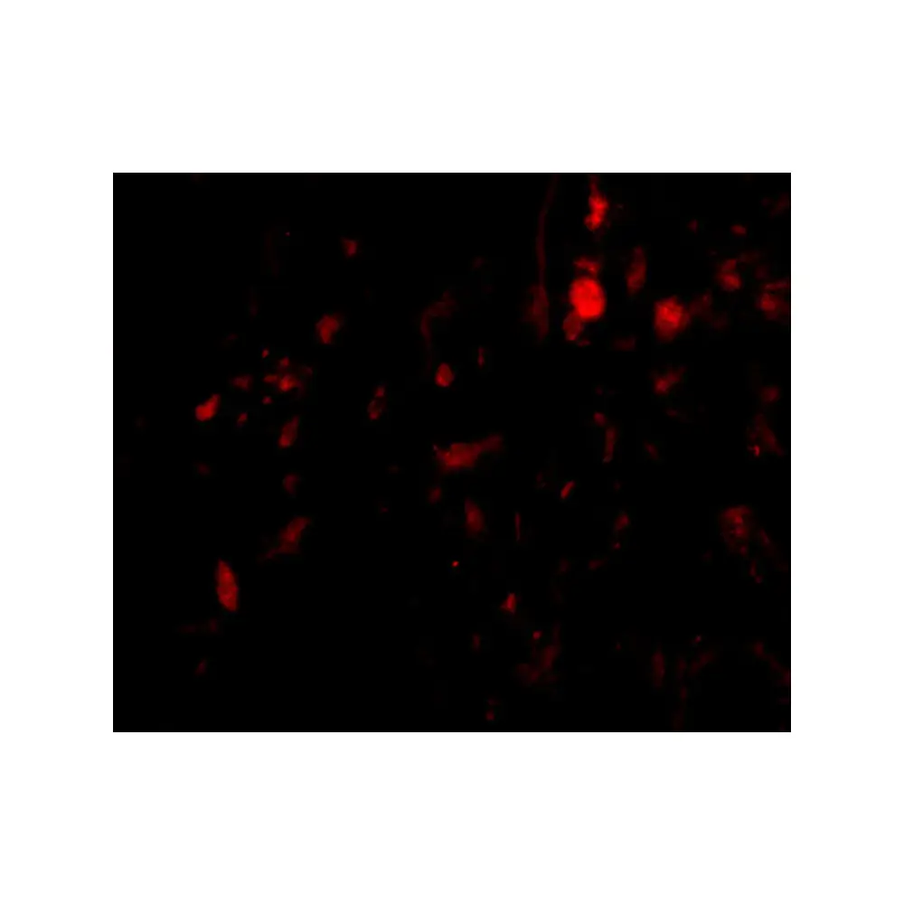 ProSci 4759 CAPN6 Antibody, ProSci, 0.1 mg/Unit Tertiary Image
