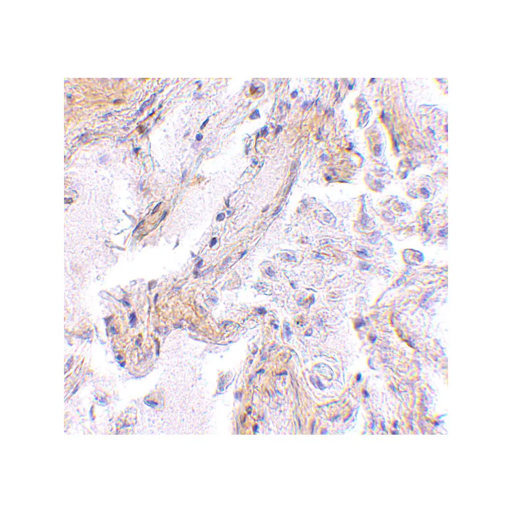 ProSci 4759 CAPN6 Antibody, ProSci, 0.1 mg/Unit Secondary Image