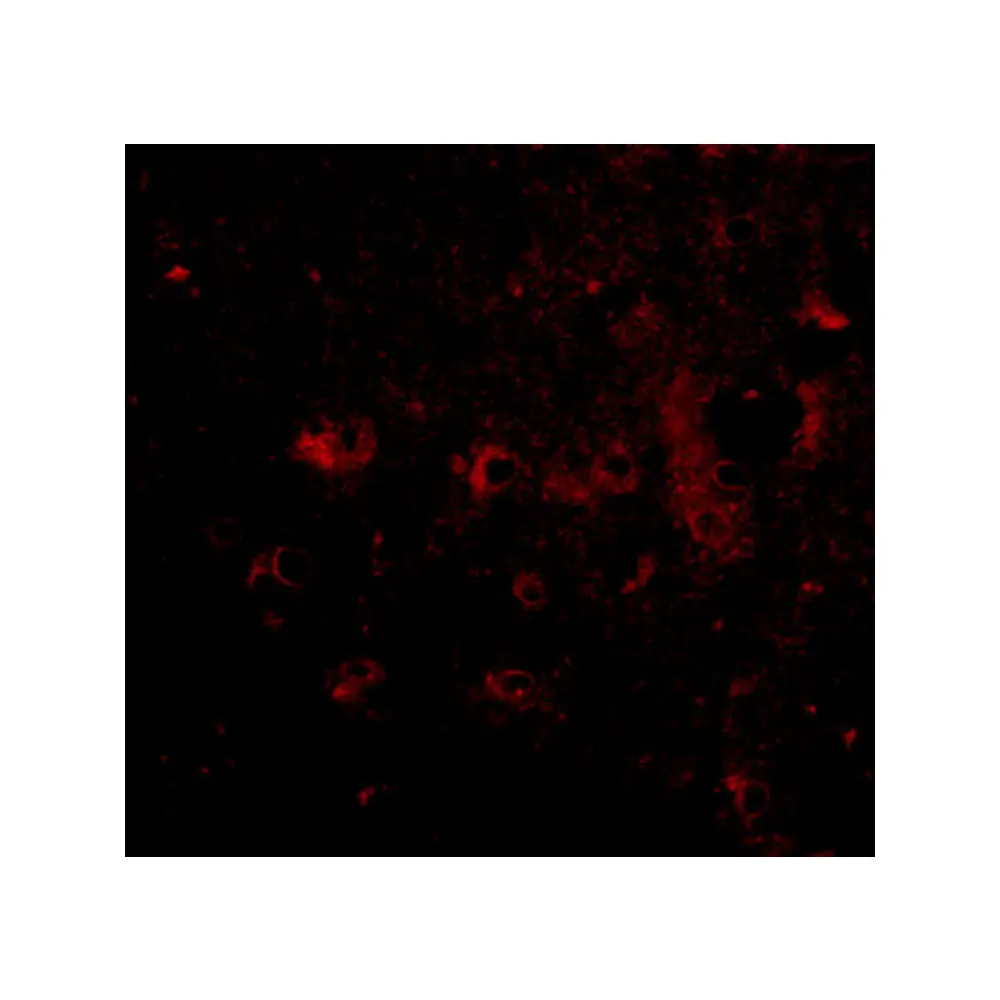 ProSci 4565 CAPS2 Antibody, ProSci, 0.1 mg/Unit Tertiary Image