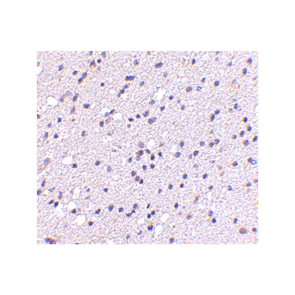 ProSci 4565 CAPS2 Antibody, ProSci, 0.1 mg/Unit Secondary Image