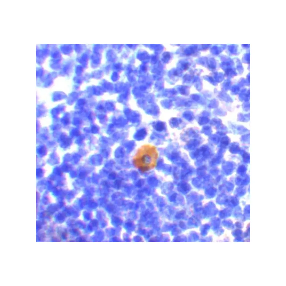 ProSci 3189 CARMA1 Antibody, ProSci, 0.1 mg/Unit Secondary Image