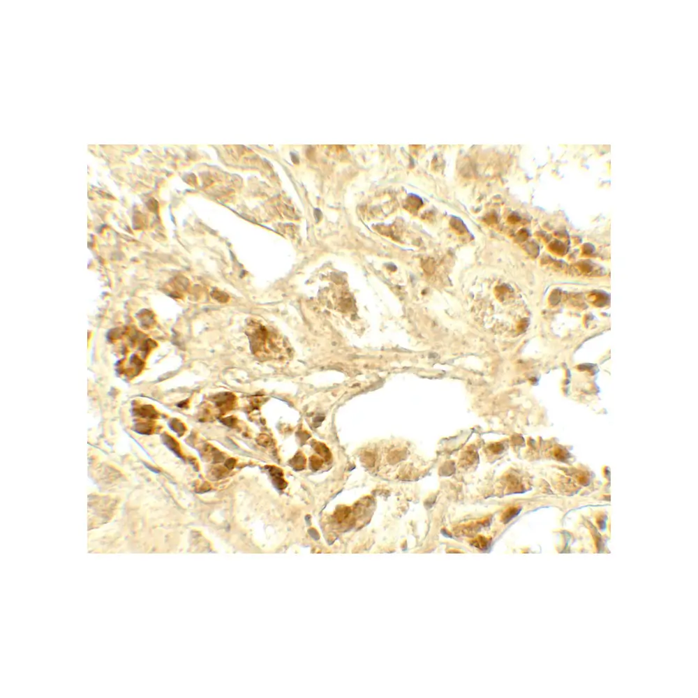 ProSci 7785 CASR Antibody, ProSci, 0.1 mg/Unit Secondary Image