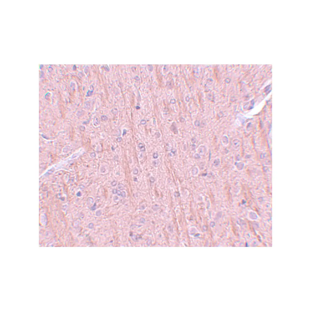 ProSci 5865 CCDC106 Antibody, ProSci, 0.1 mg/Unit Secondary Image