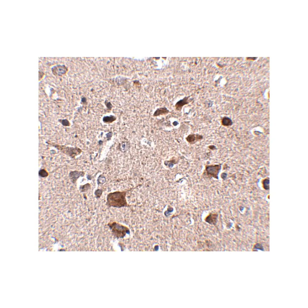ProSci 5265 CCDC134 Antibody, ProSci, 0.1 mg/Unit Secondary Image