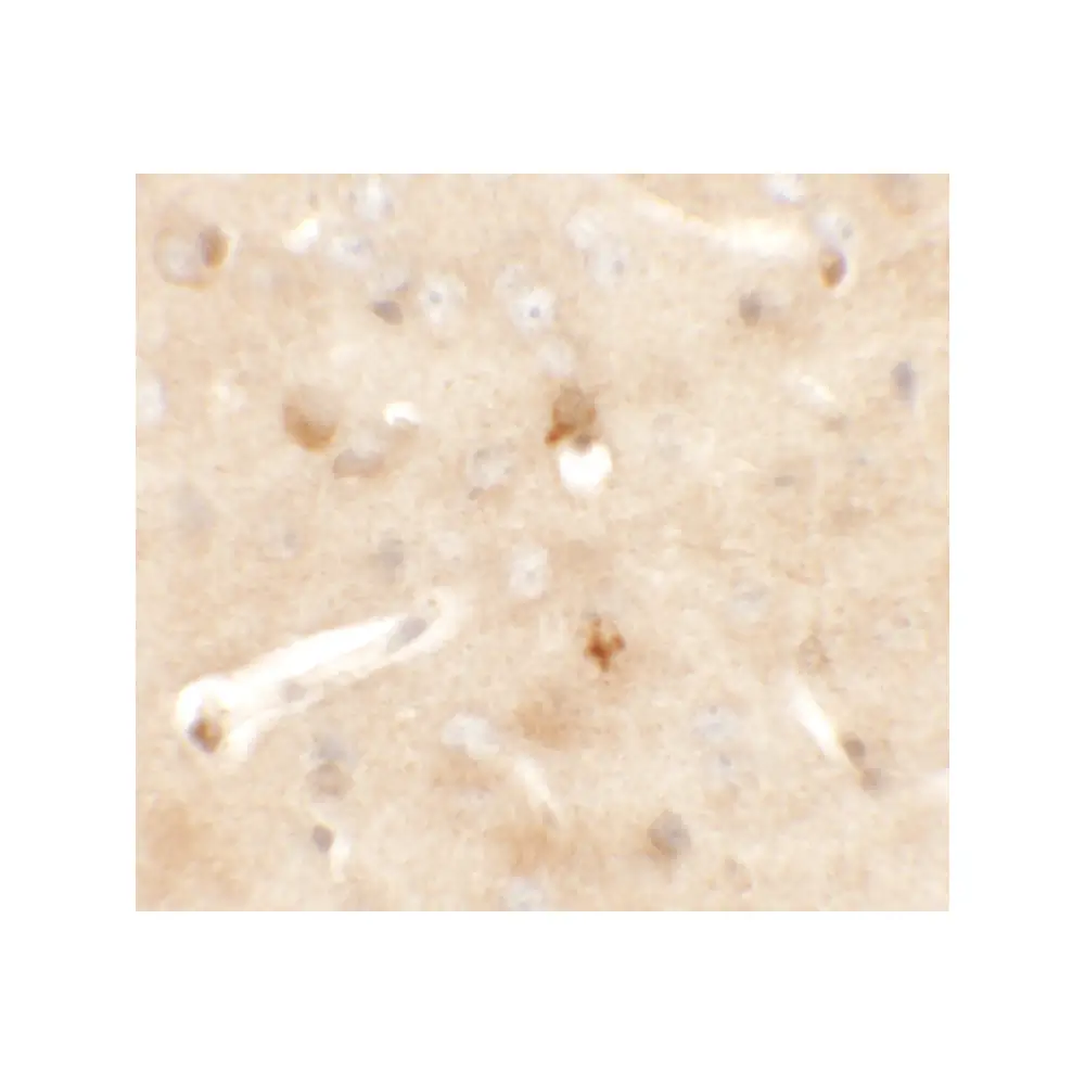 ProSci 6399_S CCDC141 Antibody, ProSci, 0.02 mg/Unit Secondary Image