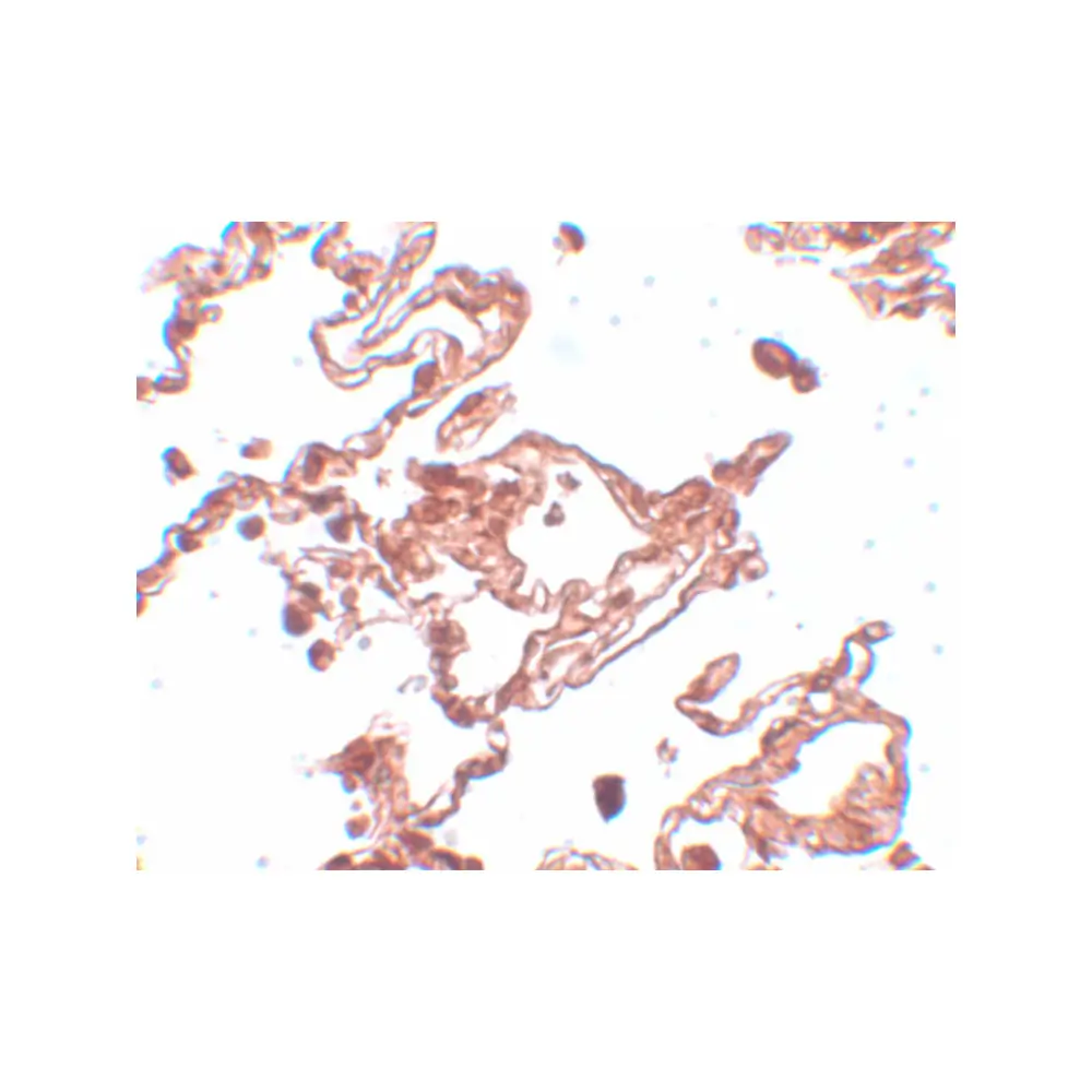 ProSci 5691 CCDC69 Antibody, ProSci, 0.1 mg/Unit Secondary Image