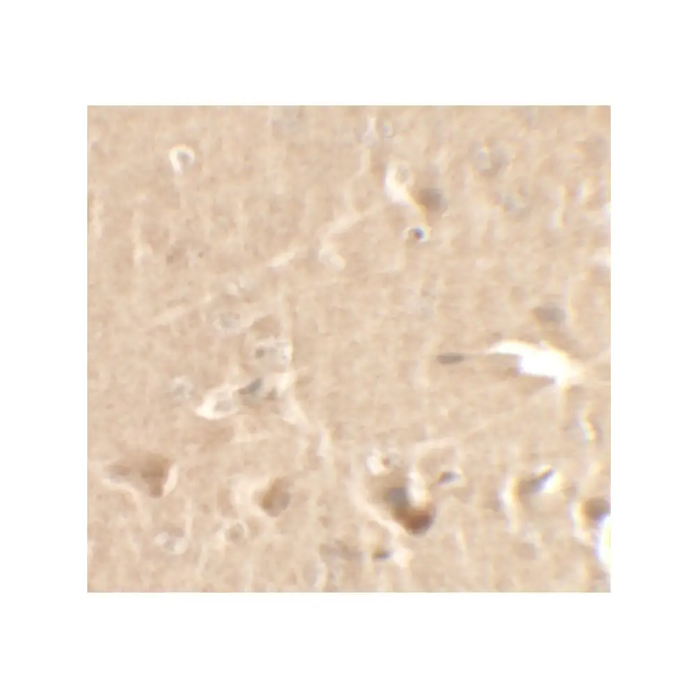 ProSci 7223 CCNT1 Antibody, ProSci, 0.1 mg/Unit Secondary Image