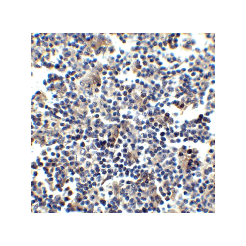 ProSci 1112_S CCR5 Antibody, ProSci, 0.02 mg/Unit Tertiary Image