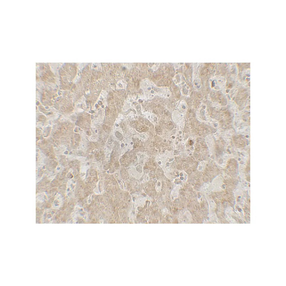 ProSci 7649_S CCR7 Antibody, ProSci, 0.02 mg/Unit Secondary Image