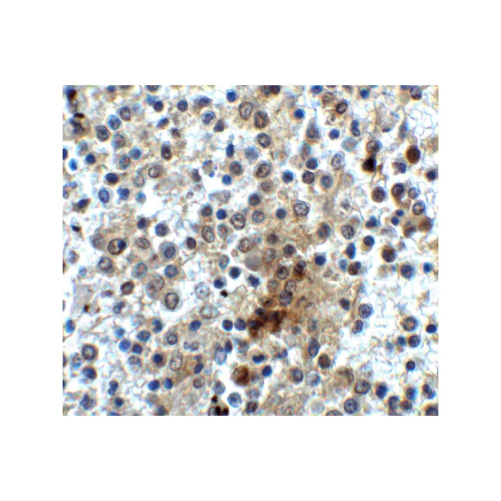 ProSci 8683 CD28 Antibody, ProSci, 0.1 mg/Unit Secondary Image