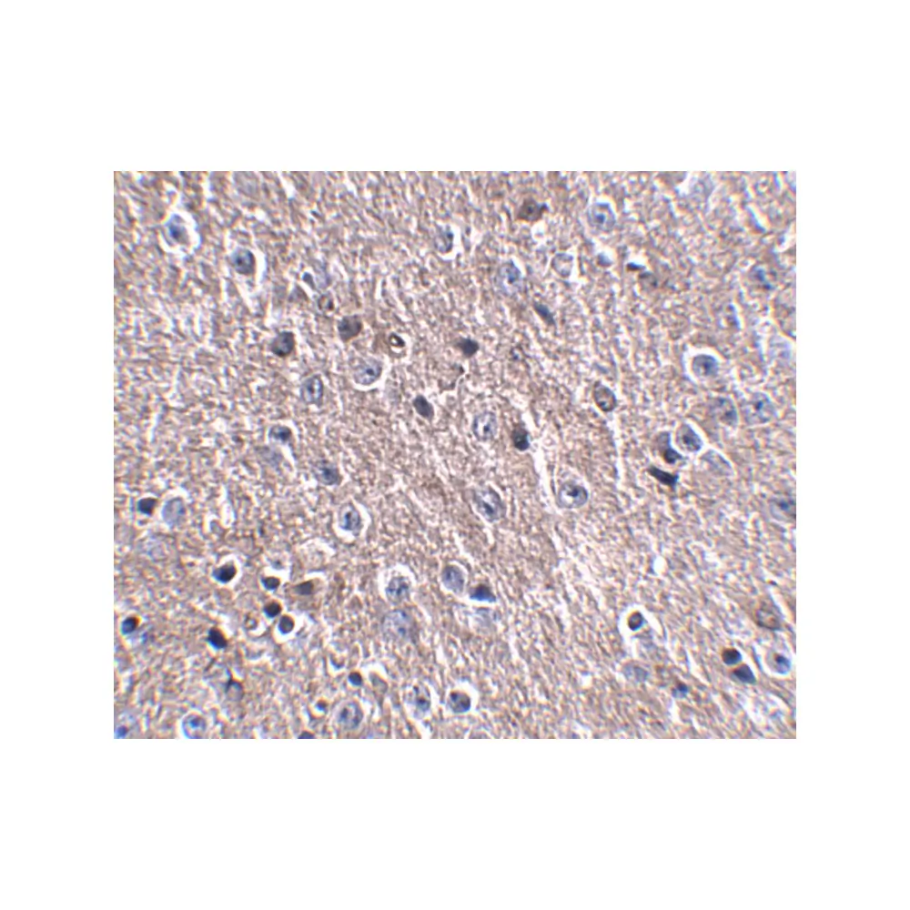 ProSci 5047 CDIP Antibody, ProSci, 0.1 mg/Unit Secondary Image