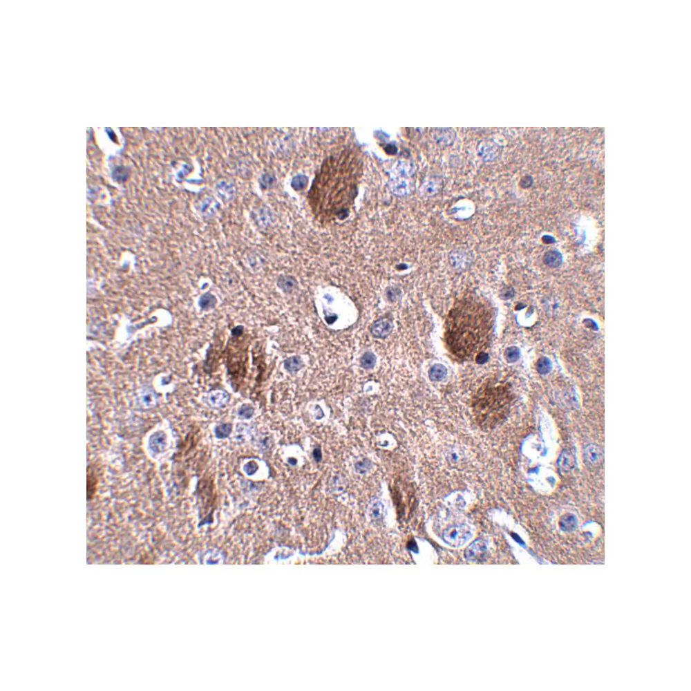 ProSci 5059 CDIP Antibody, ProSci, 0.1 mg/Unit Secondary Image