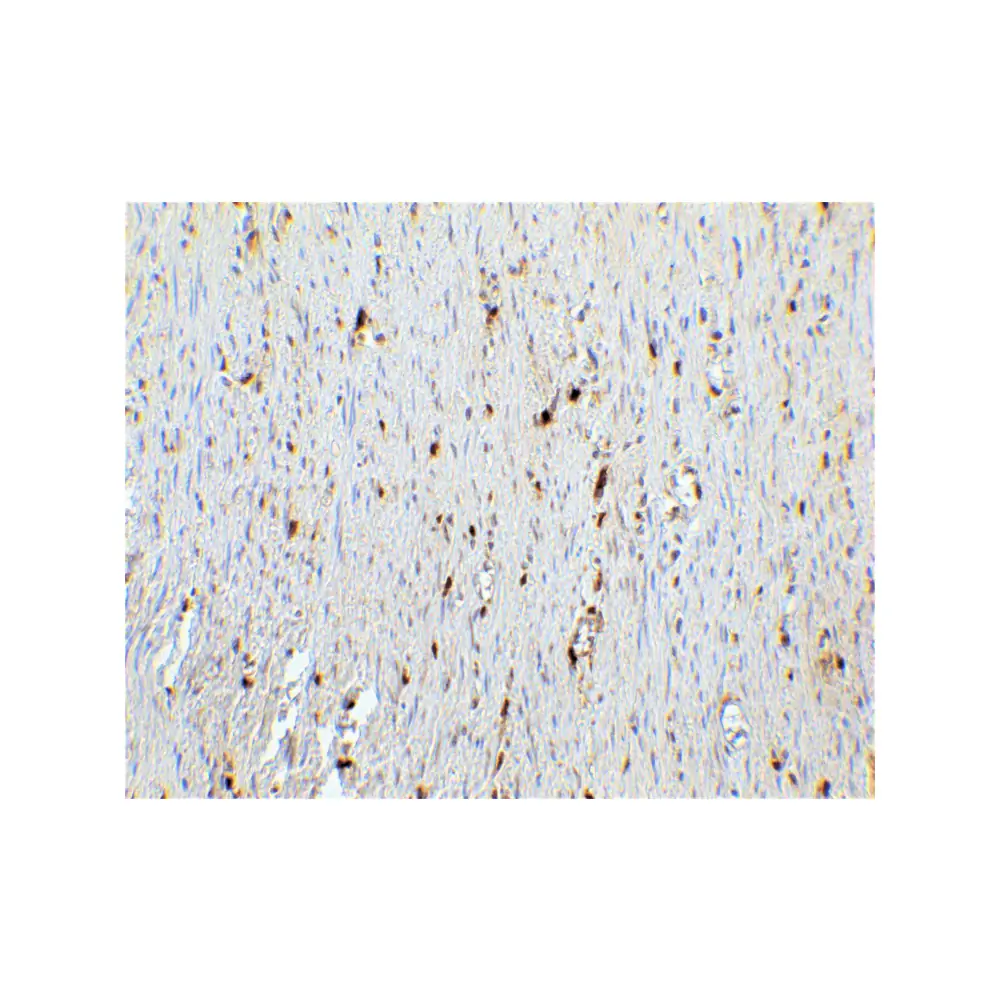 ProSci 8975 CDKN2A Antibody, ProSci, 0.1 mg/Unit Quaternary Image