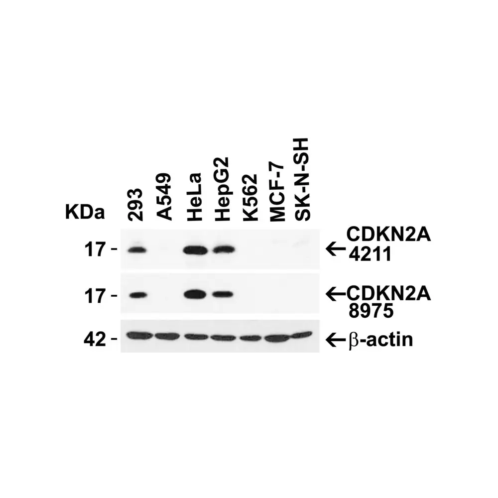 ProSci 8975_S CDKN2A Antibody, ProSci, 0.02 mg/Unit Secondary Image