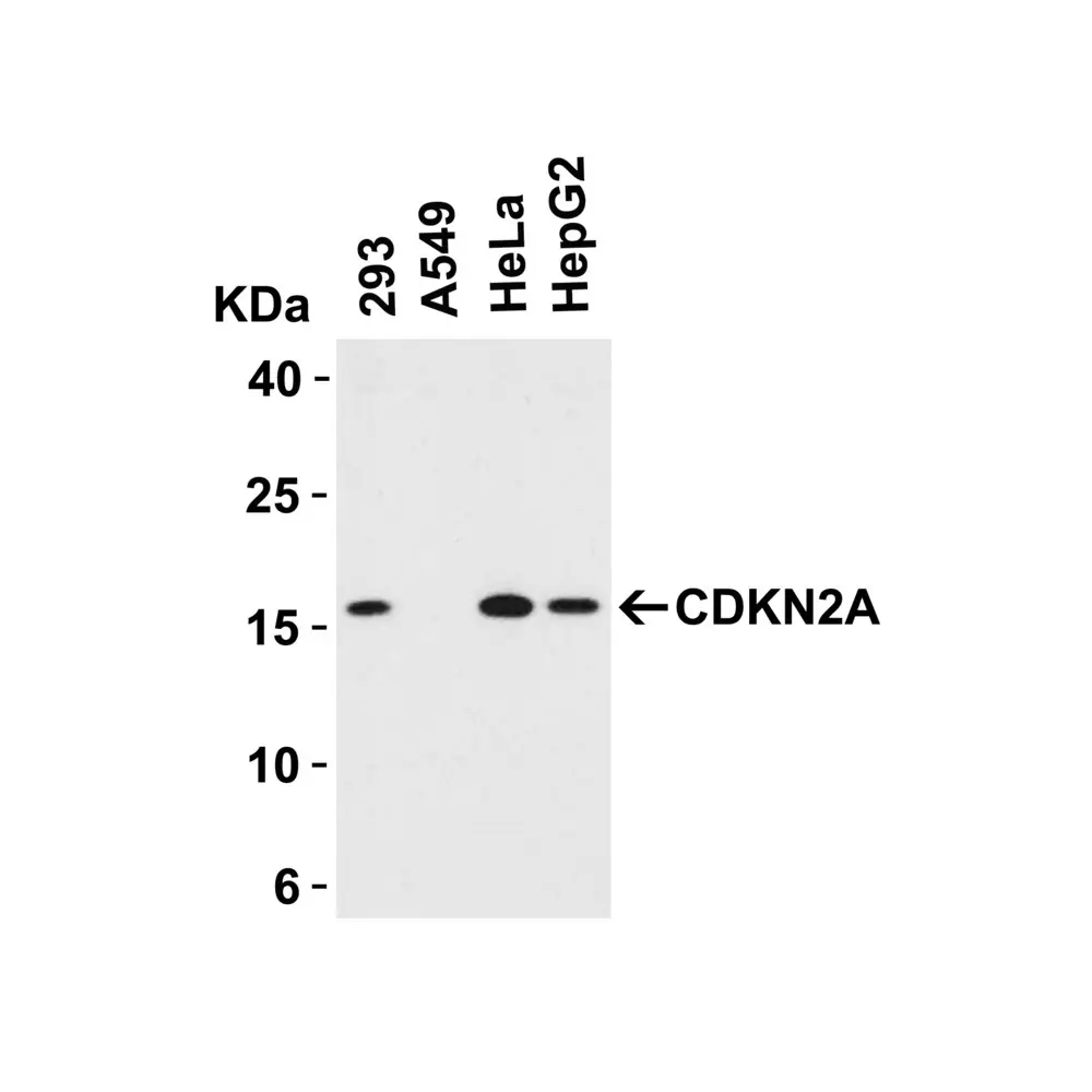 ProSci 8975_S CDKN2A Antibody, ProSci, 0.02 mg/Unit Tertiary Image