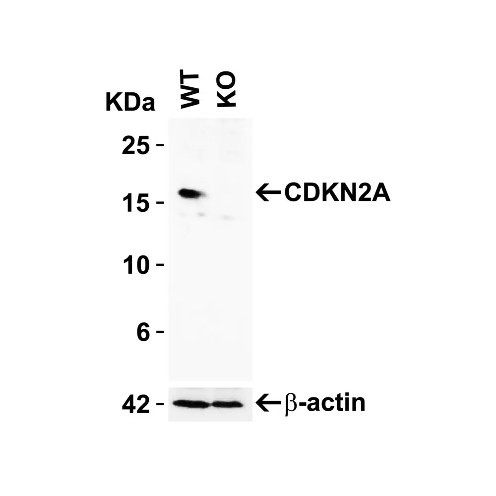 ProSci 4211_S CDKN2A Antibody, ProSci, 0.02 mg/Unit Primary Image