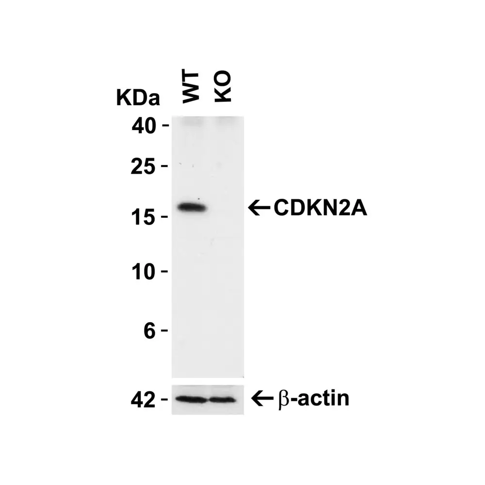 ProSci 8975 CDKN2A Antibody, ProSci, 0.1 mg/Unit Primary Image