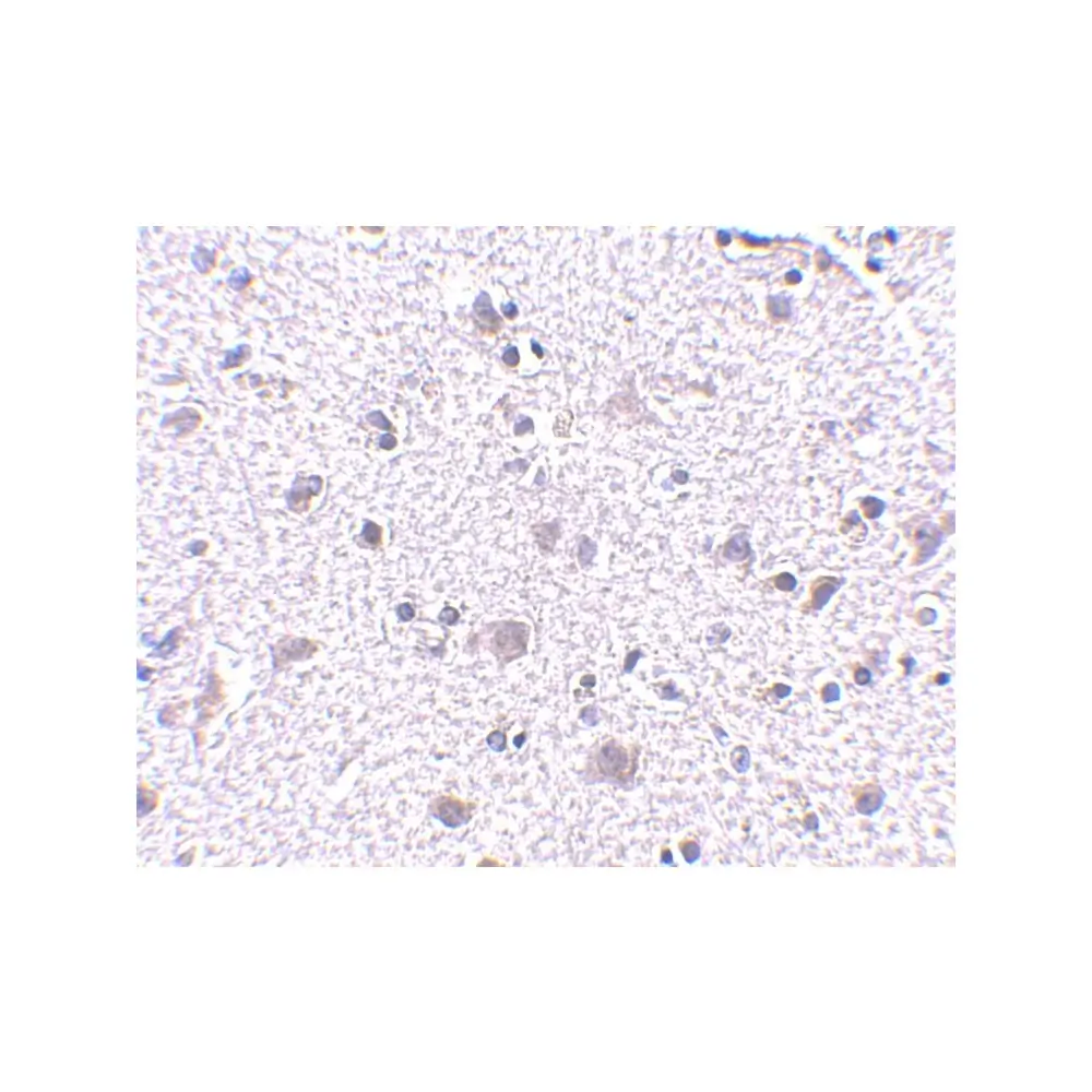 ProSci 4345_S CDNF Antibody, ProSci, 0.02 mg/Unit Secondary Image