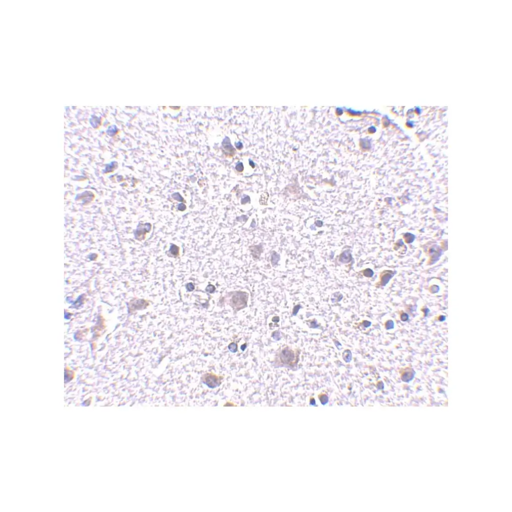 ProSci 4345 CDNF Antibody, ProSci, 0.1 mg/Unit Secondary Image