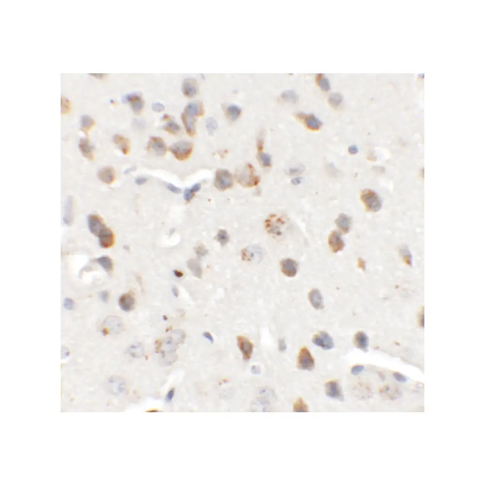 ProSci 6441 CHD7 Antibody, ProSci, 0.1 mg/Unit Secondary Image