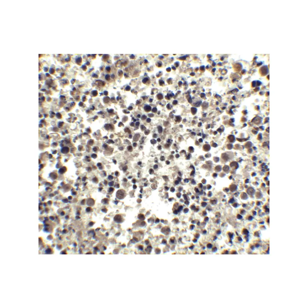ProSci 2089 CIDE-A Antibody, ProSci, 0.1 mg/Unit Quaternary Image