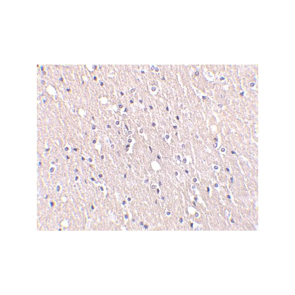 ProSci 2085 CIDE-A Antibody, ProSci, 0.1 mg/Unit Secondary Image